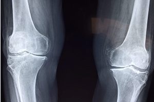 Metagenics Bone Builder with Magnesium