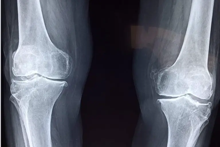 Metagenics Bone Builder with Magnesium