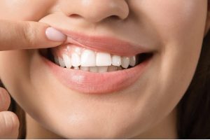Smartmouth Toothpaste