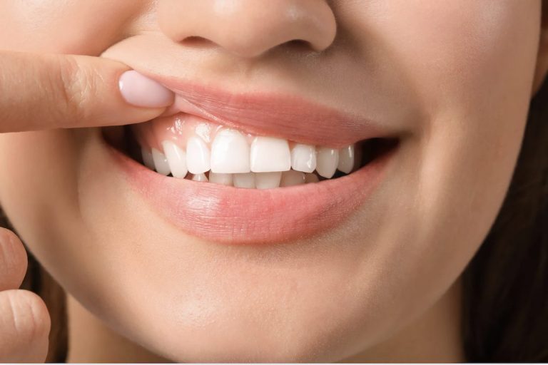 Smartmouth Toothpaste